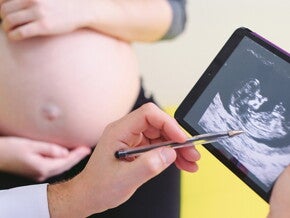 如何透過超聲波辨男女?